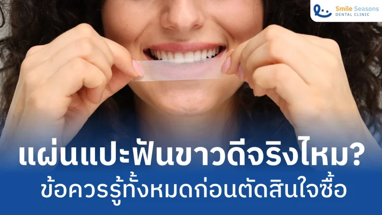 แผ่นแปะฟันขาวดีจริงไหม? ข้อควรรู้ทั้งหมดก่อนตัดสินใจซื้อ