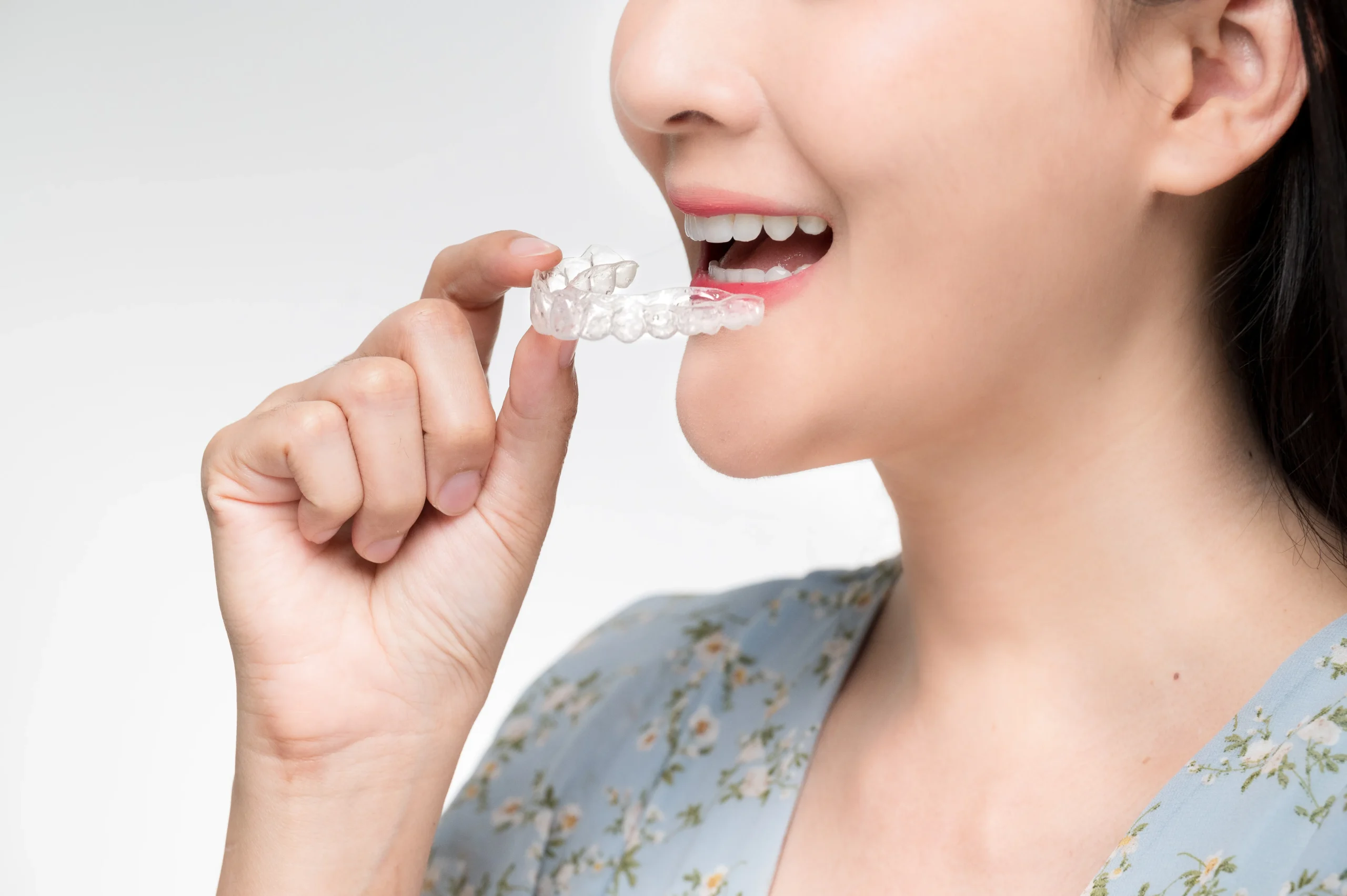 ผู้หญิงยิ้มอย่างมั่นใจพร้อมกับเครื่องมือจัดฟันใส Invisalign