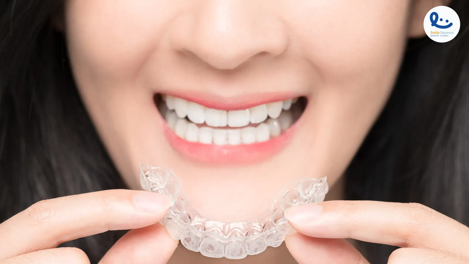 เปรียบเทียบจัดฟันใส Invisalign