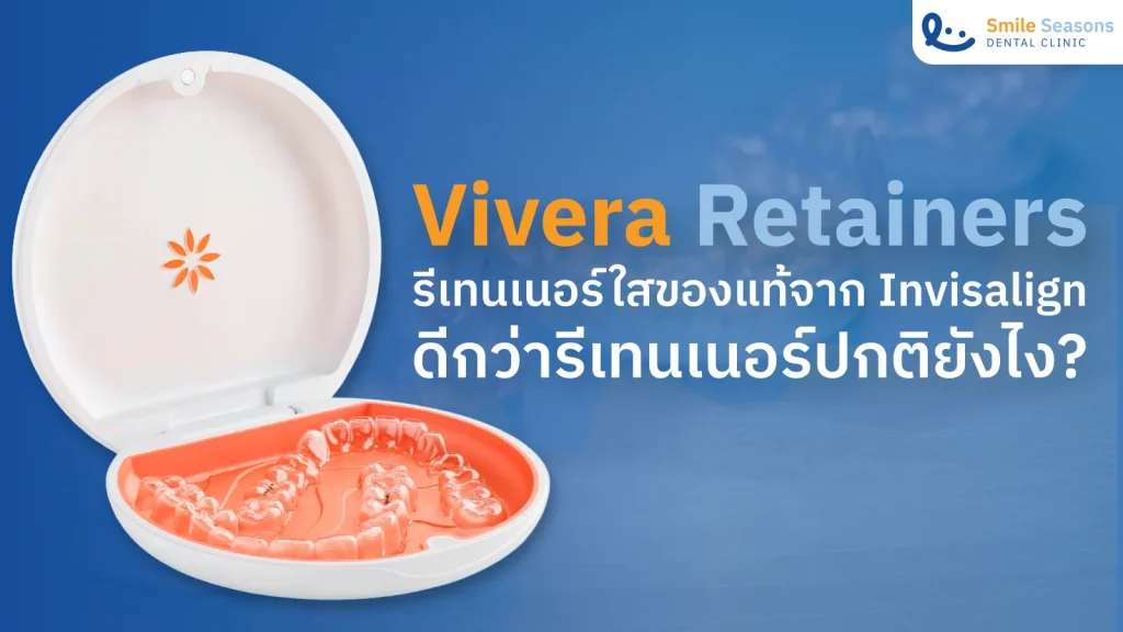 Vivera Retainer