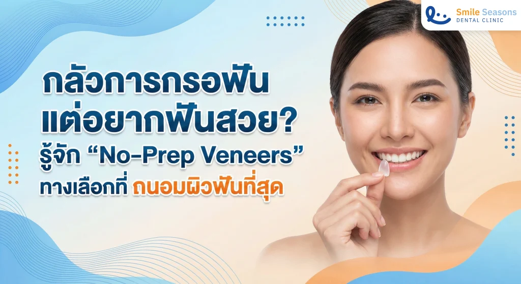 No-Prep Veneers