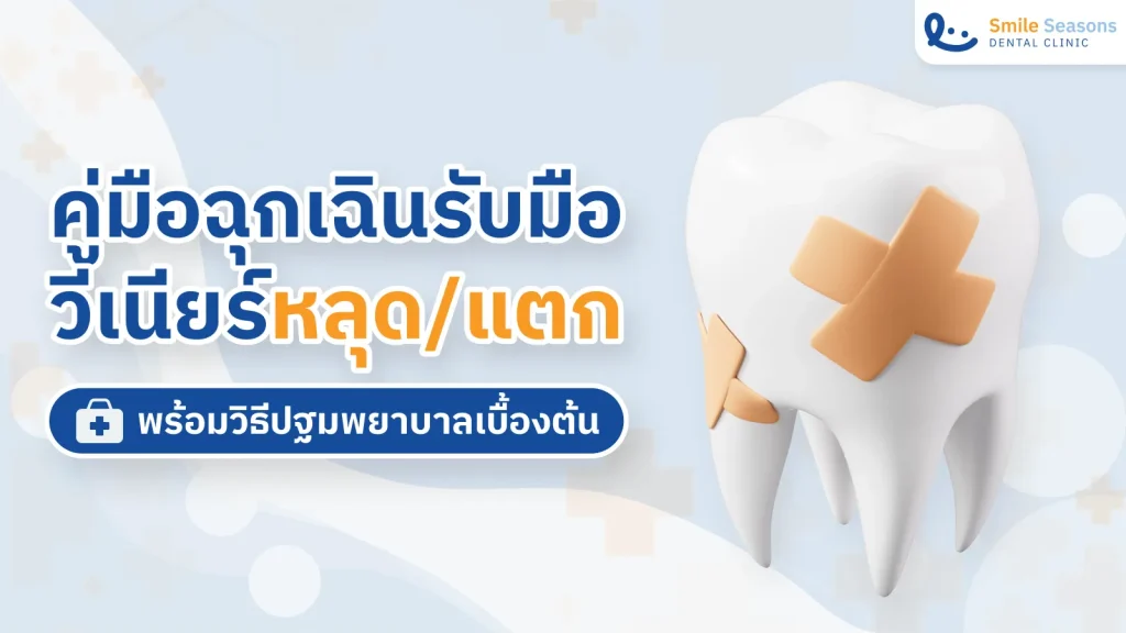 คู่มือฉุกเฉินรับมือ วีเนียร์หลุด:แตก