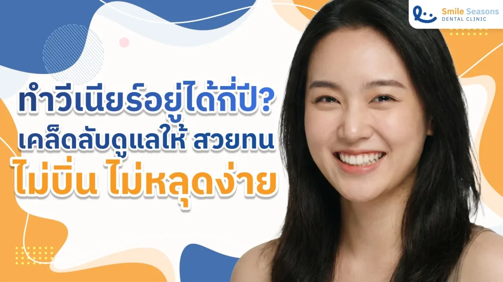 ทำวีเนียร์อยู่ได้กี่ปี? เคล็ดลับดูแลให้ สวยทน