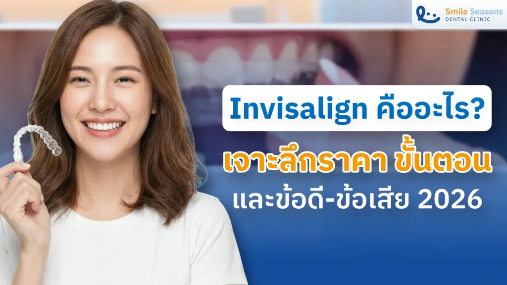 Invisalign คืออะไร? เจาะลึกราคา ขั้นตอน และข้อดีข้อเสีย 2026