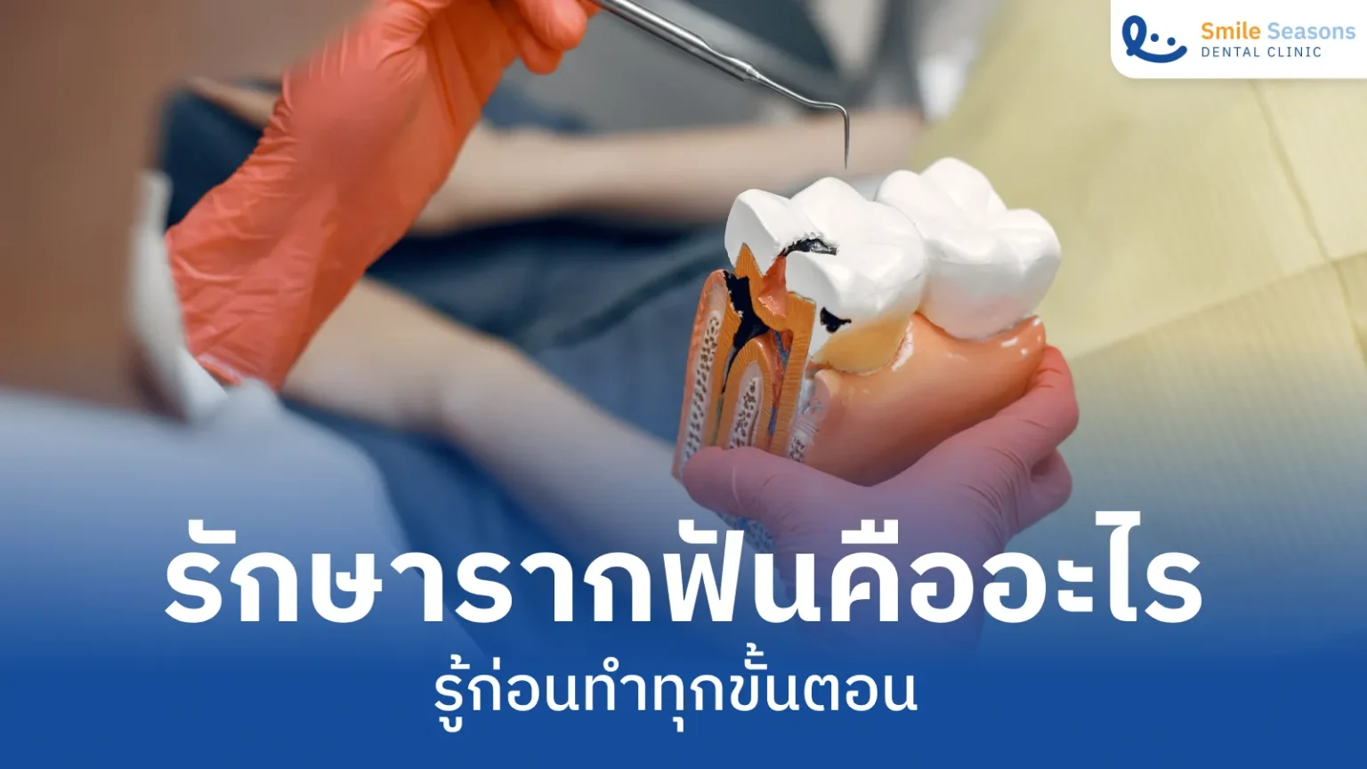 รักษารากฟันคืออะไร เจ็บไหม