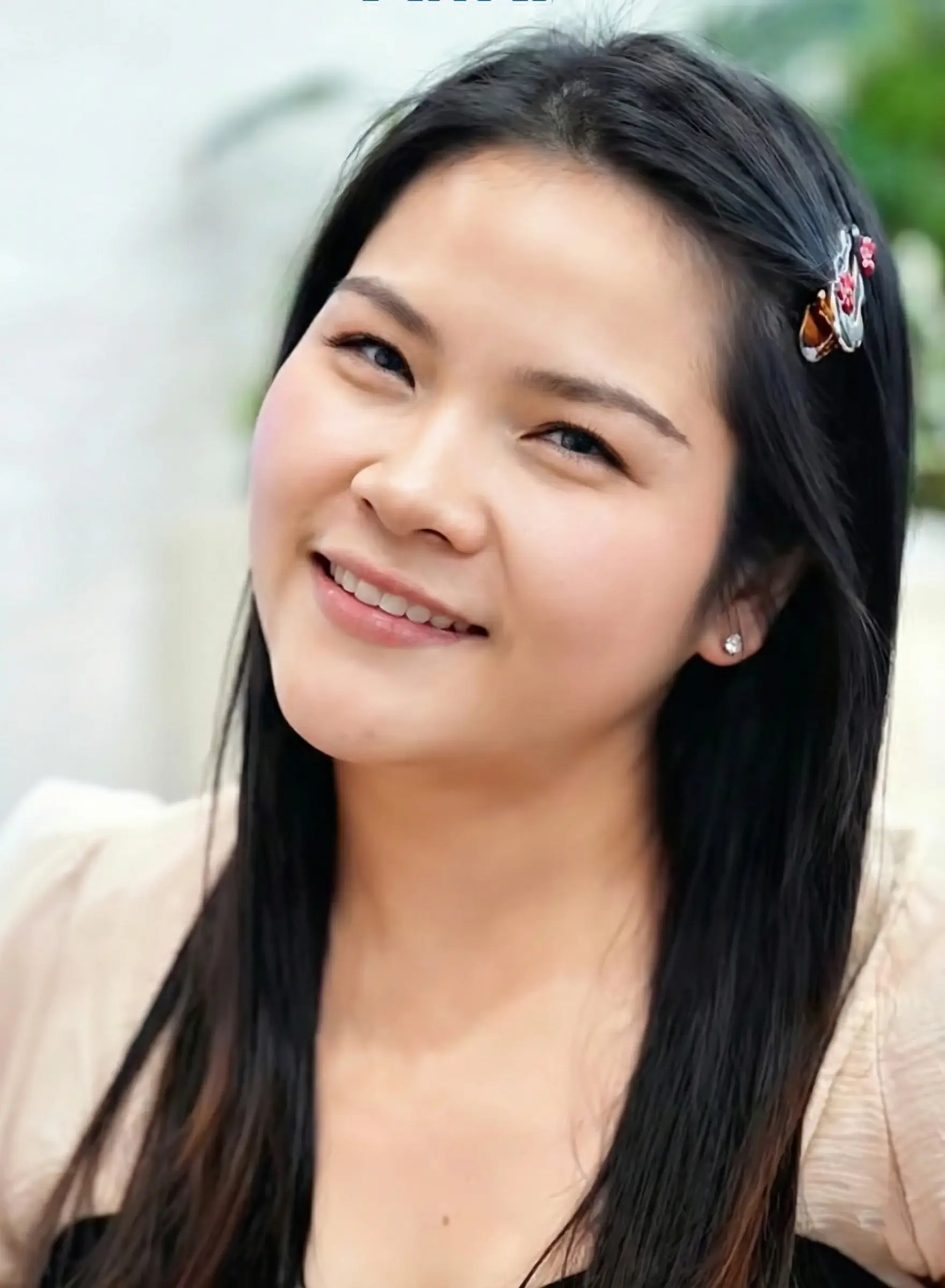 รูปหน้าหลังจัดฟัน