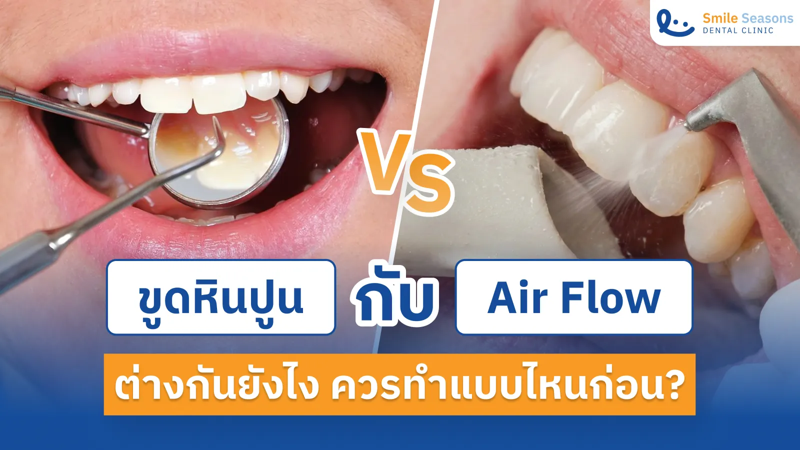 Air Flow กับ ขูดหินปูน ต่างกันยังไง ควรทำแบบไหนก่อน