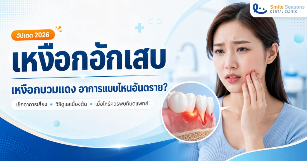 เหงือกอักเสบ เหงือกบวมแดง อาการแบบไหนอันตราย? อัปเดตวิธีรักษา 2026