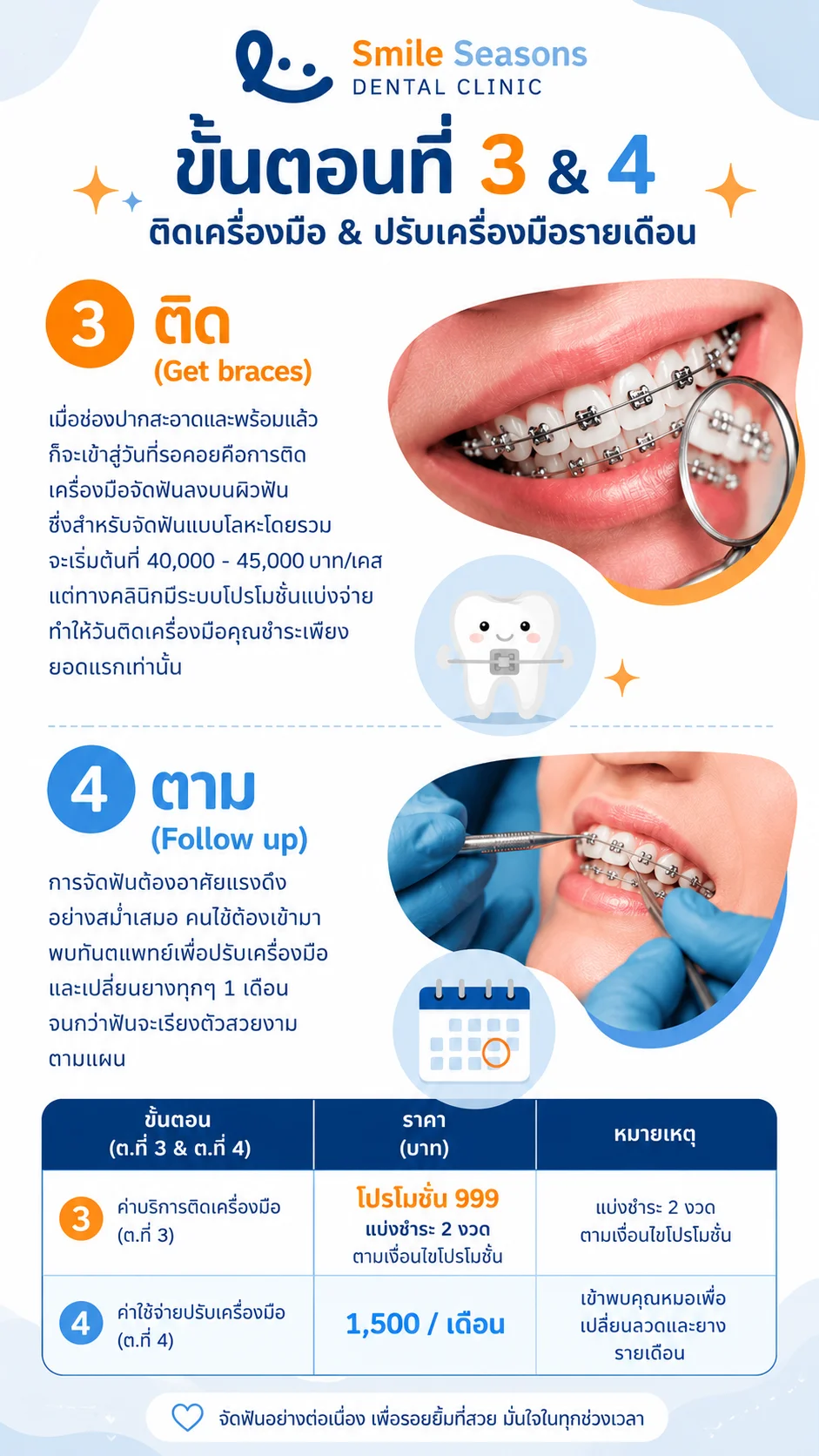 การติดเครื่องมือจัดฟันเหล็กและการปรับเครื่องมือรายเดือน ที่ Smile Seasons