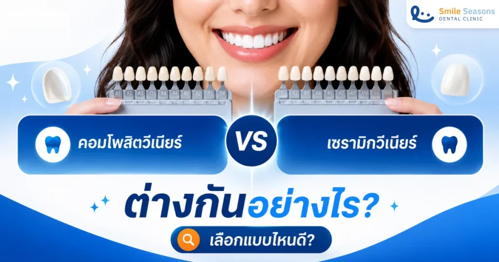 คอมโพสิตวีเนียร์ vs เซรามิกวีเนียร์ ต่างกันอย่างไร เลือกแบบไหนดี?