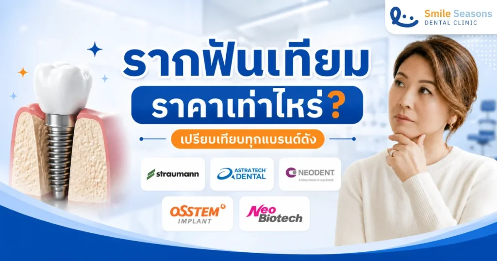 รากฟันเทียม ราคา เท่าไหร่? เปรียบเทียบ 5 แบรนด์ดัง