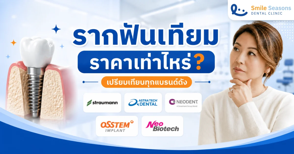 รากฟันเทียม ราคา เท่าไหร่? เปรียบเทียบ 5 แบรนด์ดัง