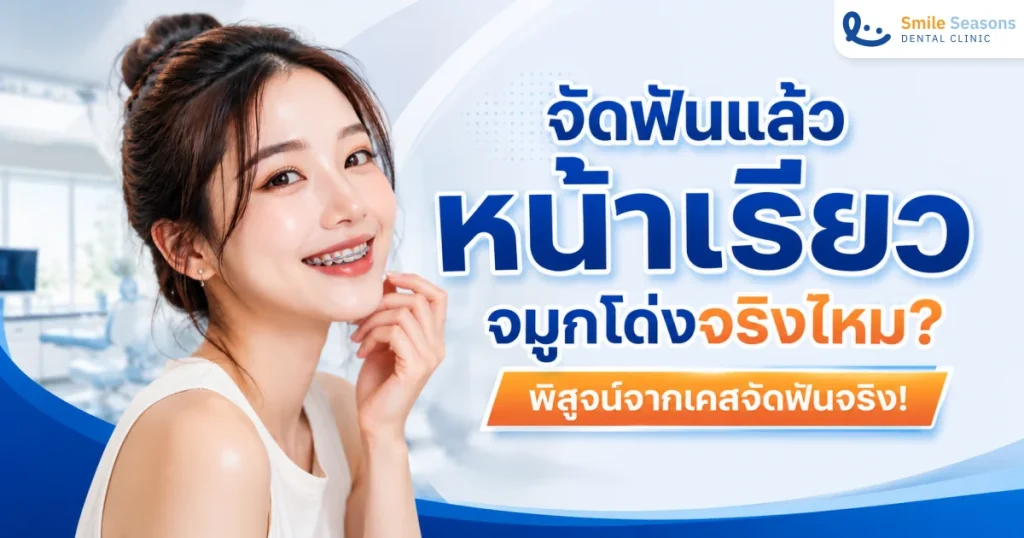 จัดฟันแล้วหน้าเรียว จมูกโด่งจริงไหม?