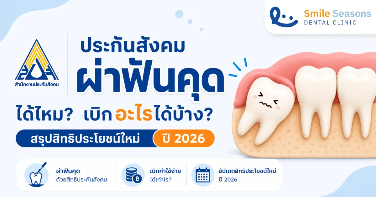 ประกันสังคม ผ่าฟันคุดได้ไหม เบิกอะไรได้บ้าง? สรุปสิทธิประโยชน์ใหม่ปี 2026