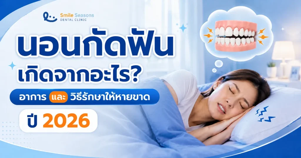 นอนกัดฟัน (Bruxism) เกิดจากอะไร อาการ และวิธีดูแลรักษา ปี 2026