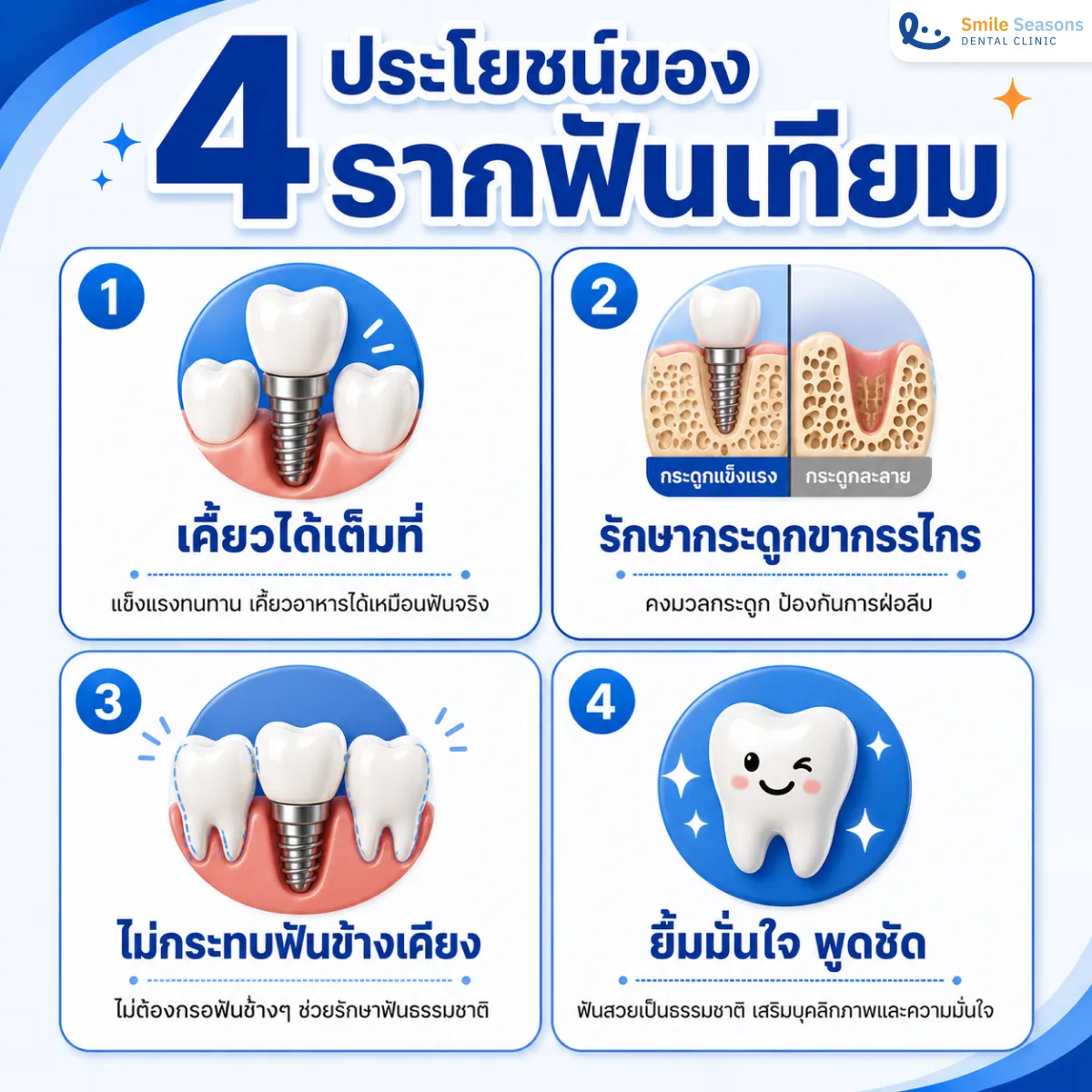 4 ประโยชน์ของรากฟันเทียม เคี้ยวได้เต็มที่ รักษากระดูก ไม่กระทบฟันข้างเคียง และยิ้มมั่นใจ