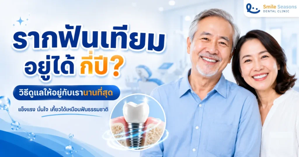 รากฟันเทียมอยู่ได้กี่ปี? เจ็บไหม วิธีดูแลให้อยู่นาน 2026