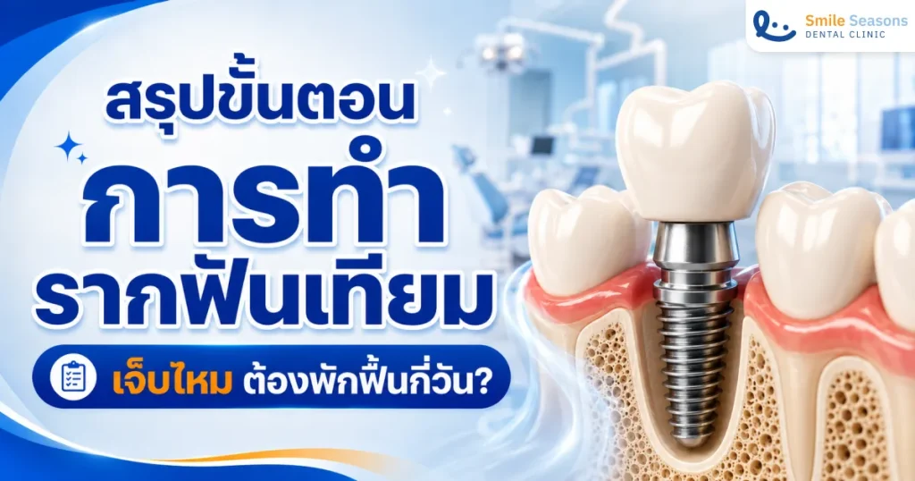 สรุปขั้นตอนการทำรากฟันเทียม เจ็บไหม ต้องพักฟื้นกี่วัน?