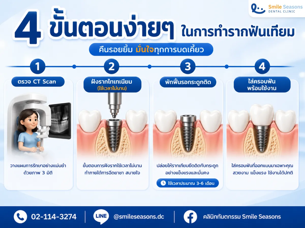4 ขั้นตอนการทำรากฟันเทียม ตรวจ CT Scan ผ่าตัดฝังราก พักฟื้น และใส่ครอบฟัน