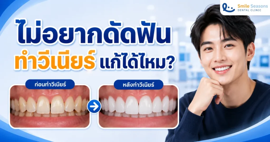 ไม่อยากดัดฟัน ทำวีเนียร์แก้ได้ไหม? ทางลัดฟันเรียงสวยแบบไม่ต้องรอนาน