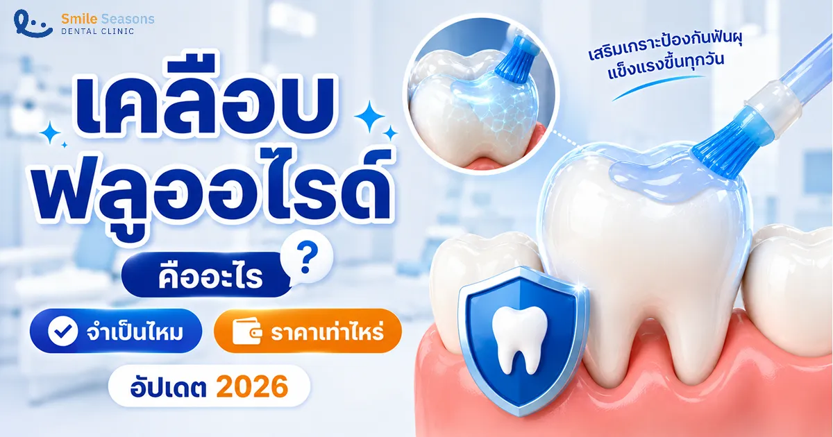 เคลือบฟลูออไรด์ คืออะไร จำเป็นไหม ราคาเท่าไหร่ อัปเดต 2026