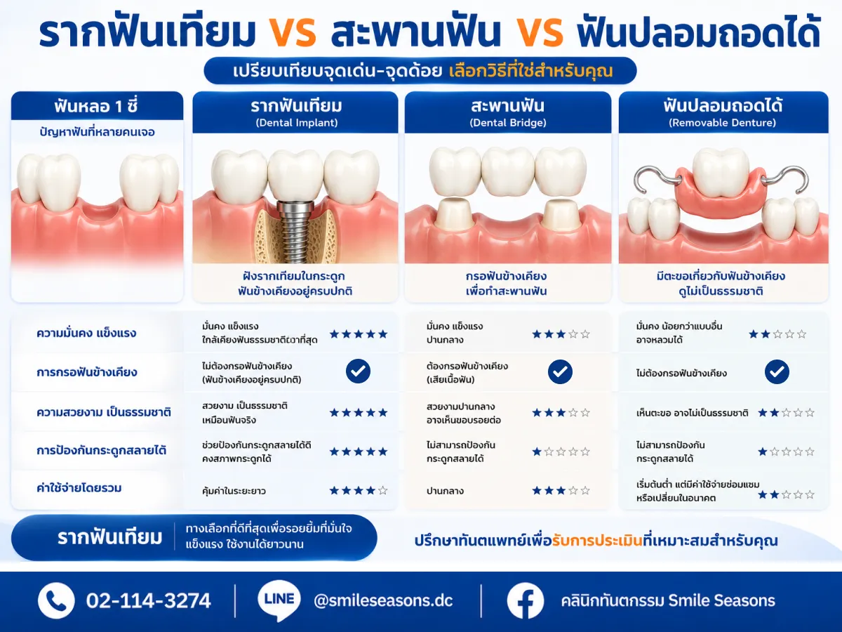 เปรียบเทียบข้อดีข้อเสีย รากฟันเทียม สะพานฟัน และฟันปลอมถอดได้