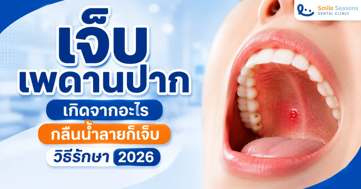 เจ็บเพดานปาก เกิดจากอะไร กลืนน้ำลายก็เจ็บ วิธีรักษา 2026
