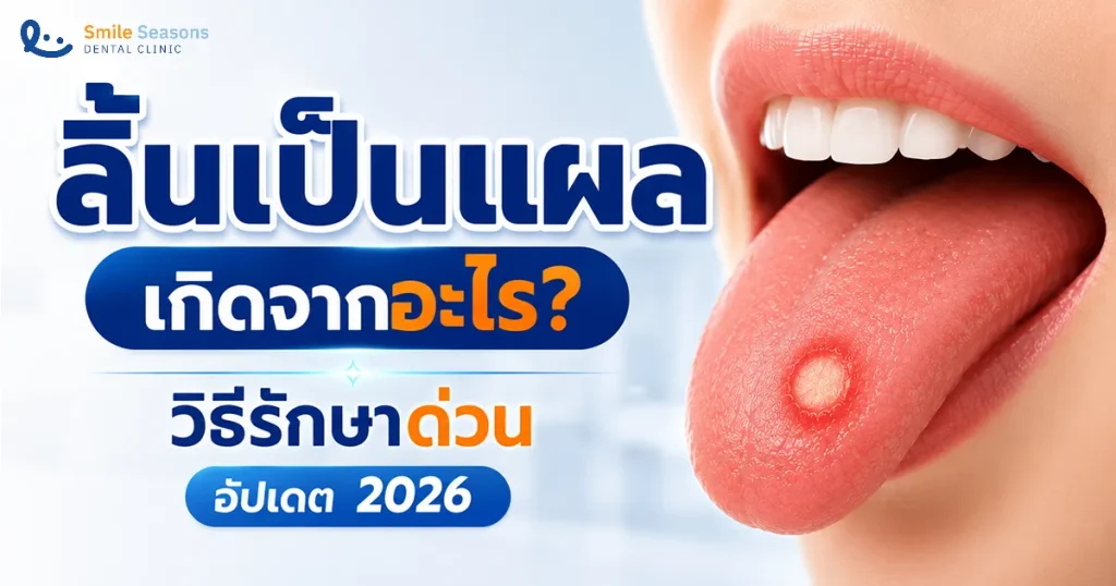 ลิ้นเป็นแผล เกิดจากอะไร? วิธีดูแลบรรเทาอาการ อัปเดต 2026