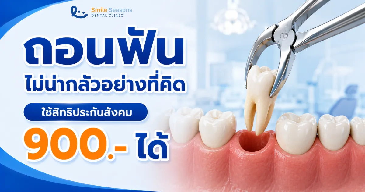 ถอนฟัน เจ็บไหม? ราคา วิธีดูแลแผลให้หายไว อัปเดต 2026