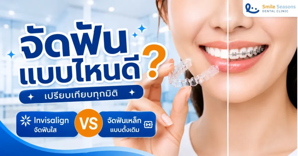 จัดฟันแบบไหนดี? เปรียบเทียบ Invisalign กับจัดฟันเหล็กทุกมิติ