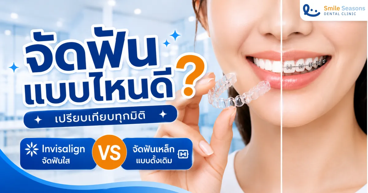 จัดฟันแบบไหนดี? เปรียบเทียบ Invisalign กับจัดฟันเหล็กทุกมิติ