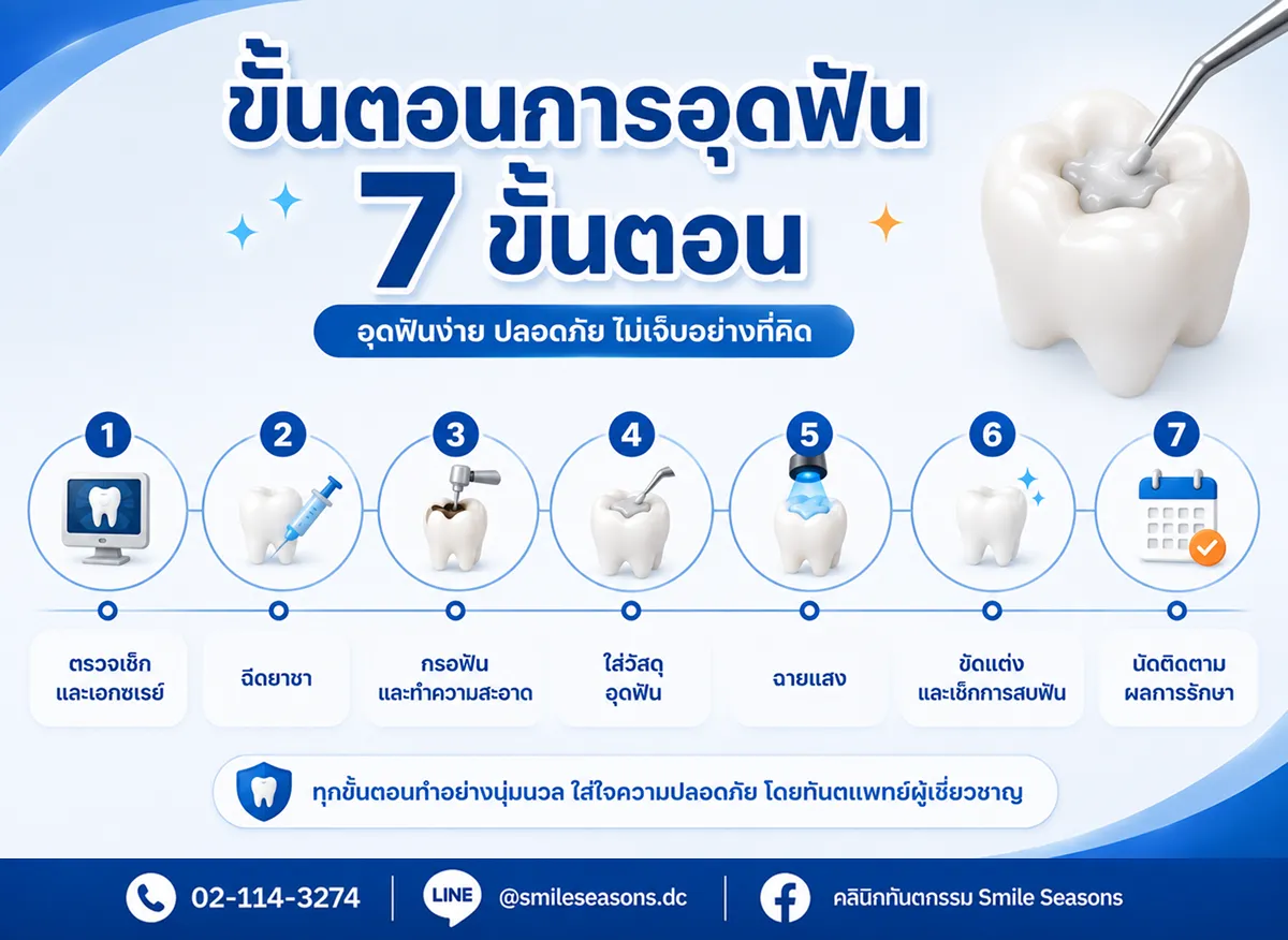 ขั้นตอนการอุดฟัน 7 ขั้นตอน