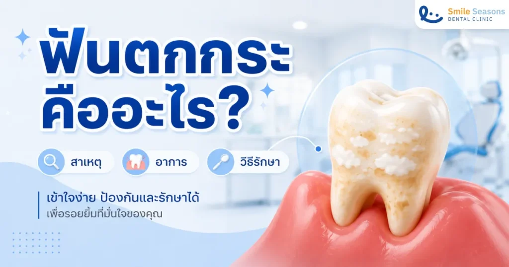 ฟันตกกระคืออะไร? สาเหตุ อาการ วิธีรักษา และราคา 2026