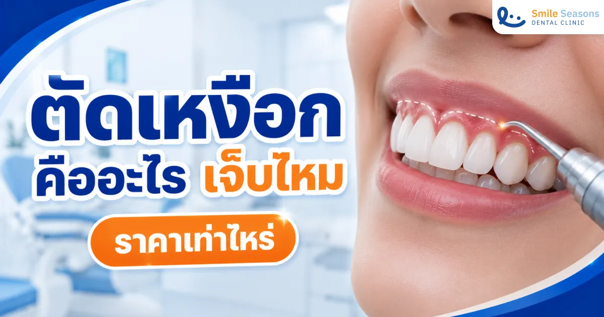 ตัดเหงือกคืออะไร เจ็บไหม ราคาเท่าไหร่ แก้เหงือกเยอะได้ไหม