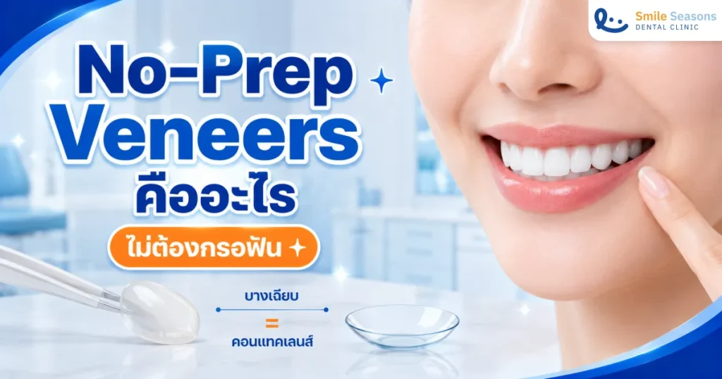 No-Prep Veneers คืออะไร วีเนียร์แบบไม่กรอฟัน เหมาะกับใคร