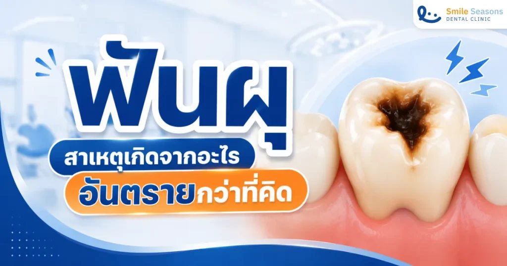 ฟันผุ สาเหตุเกิดจากอะไร อันตรายกว่าที่คิด