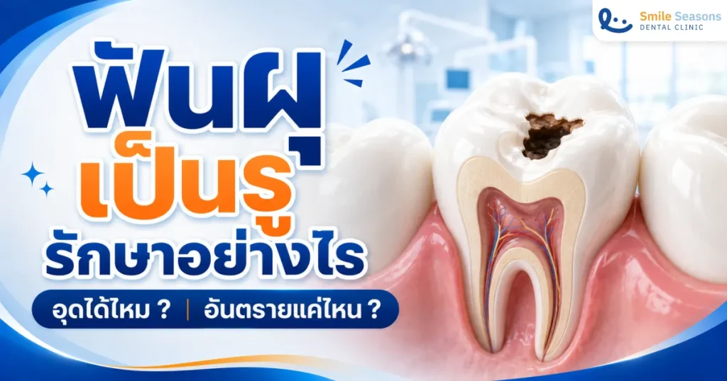 ฟันผุเป็นรูรักษาอย่างไร อุดได้ไหม อันตรายแค่ไหน