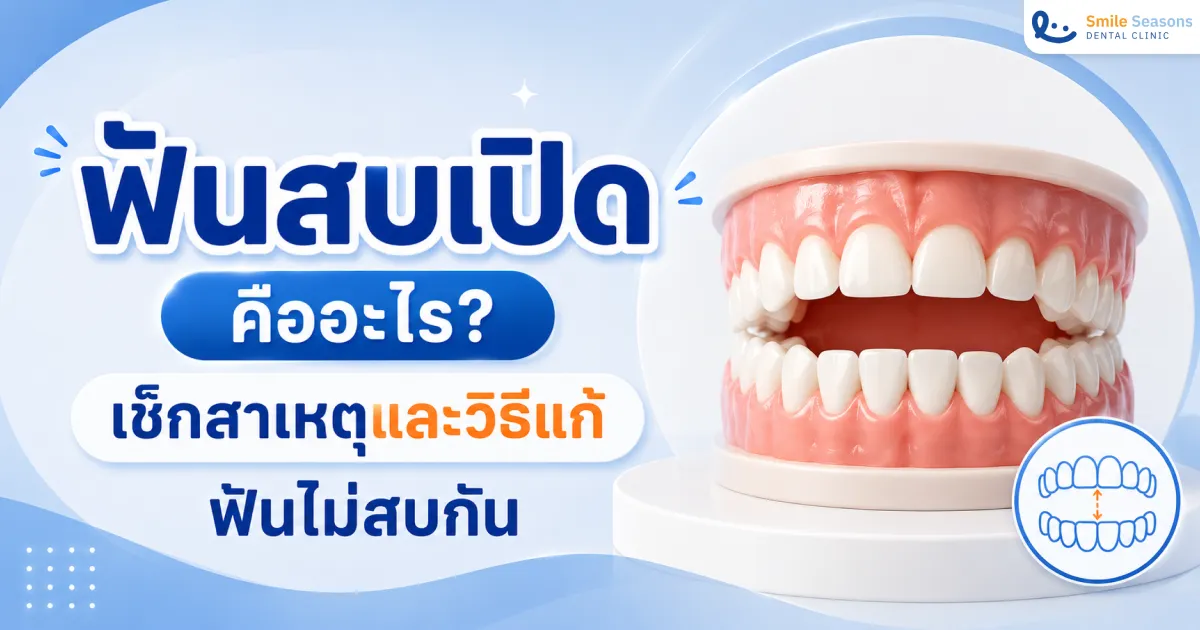 ฟันสบเปิด คืออะไร? เช็กสาเหตุและวิธีแก้ฟันไม่สบกัน