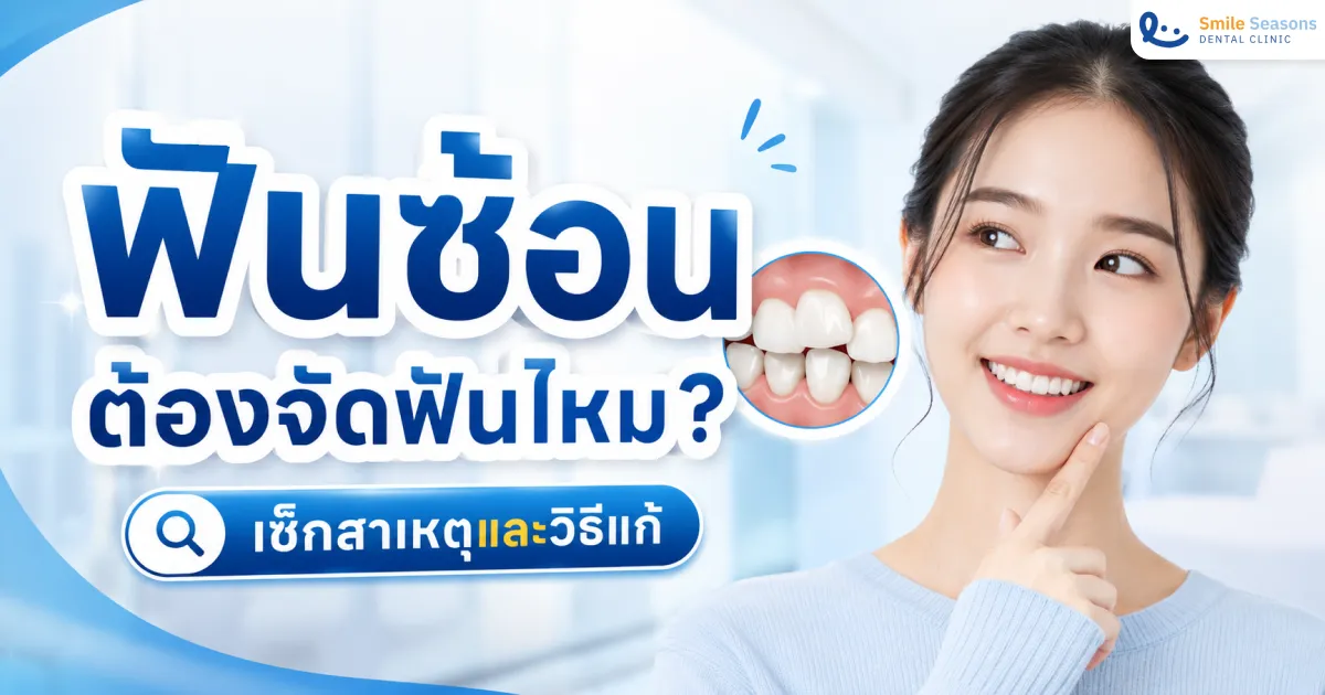 ฟันซ้อนต้องจัดฟันไหม? เช็กสาเหตุและวิธีแก้
