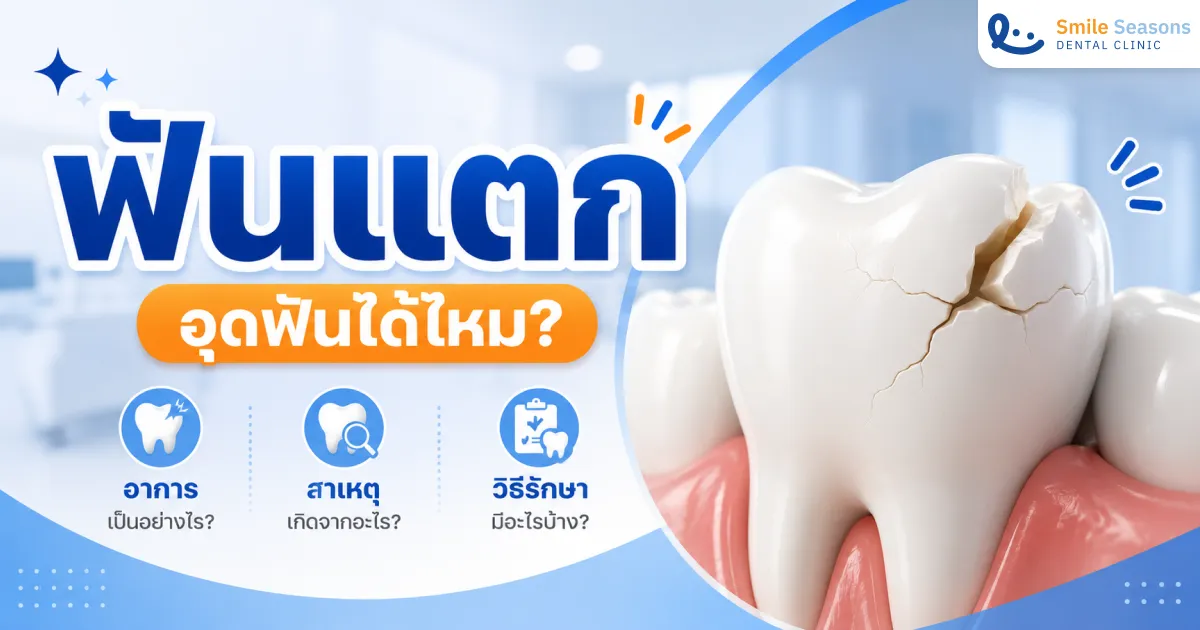 ฟันแตก อุดฟันได้ไหม อาการ สาเหตุ และวิธีรักษา 2026
