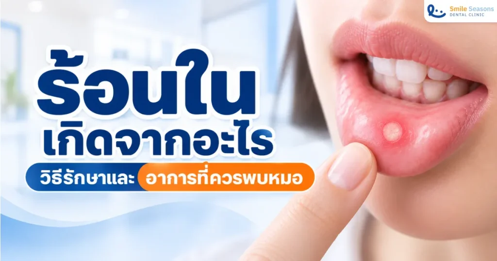 ร้อนในเกิดจากอะไร วิธีรักษาและอาการที่ควรพบหมอ