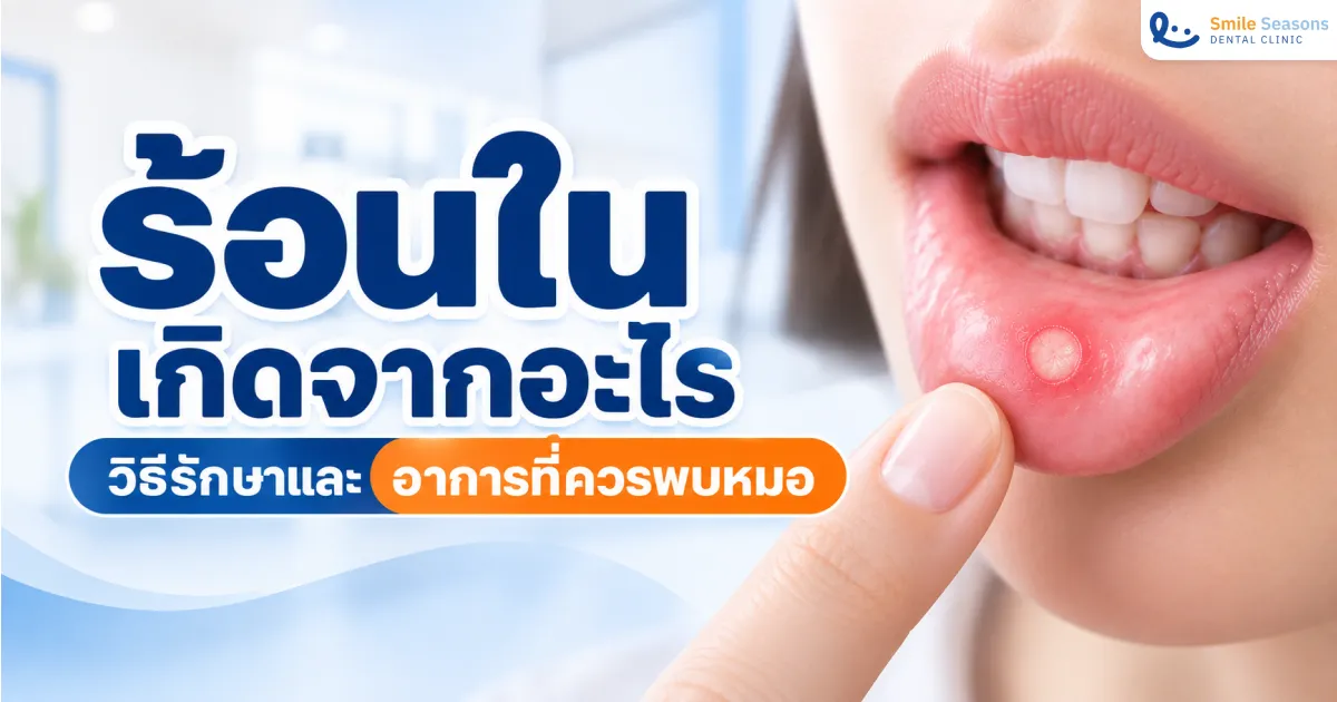 ร้อนในเกิดจากอะไร วิธีรักษาและอาการที่ควรพบหมอ