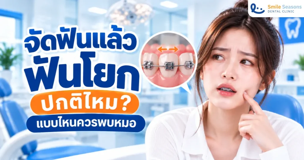 จัดฟันแล้วฟันโยก ปกติไหม แบบไหนควรพบหมอ 2026