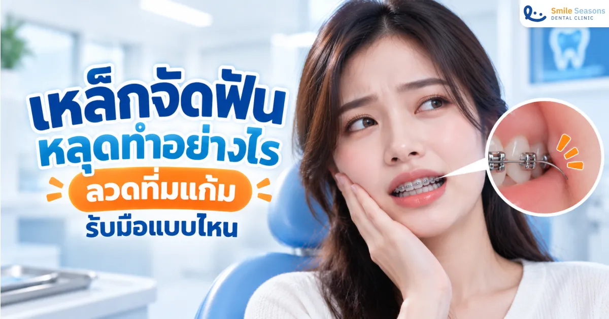 เหล็กจัดฟันหลุดทำอย่างไร ลวดทิ่มแก้มรับมือแบบไหน 2026
