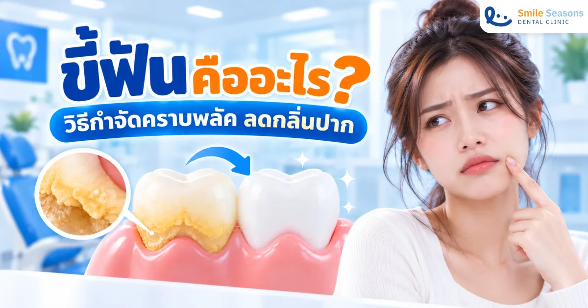 ขี้ฟันคืออะไรและวิธีกำจัดคราบพลัคเพื่อลดกลิ่นปาก 2026