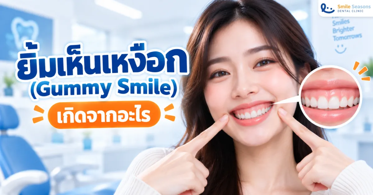 ยิ้มเห็นเหงือก (Gummy Smile) เกิดจากอะไร แก้แบบไหนดี 2026