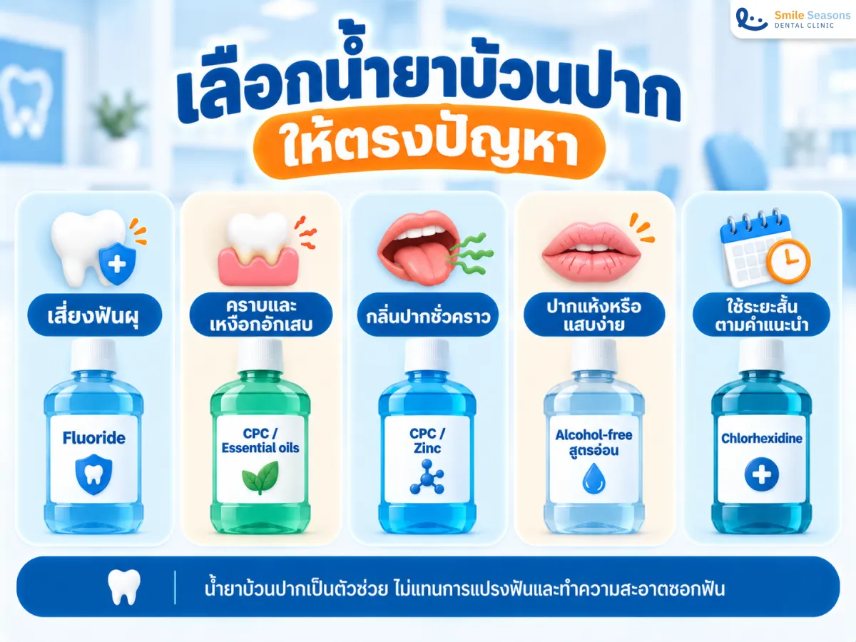 ตารางเลือกน้ำยาบ้วนปากจากปัญหาและสารออกฤทธิ์บนฉลาก