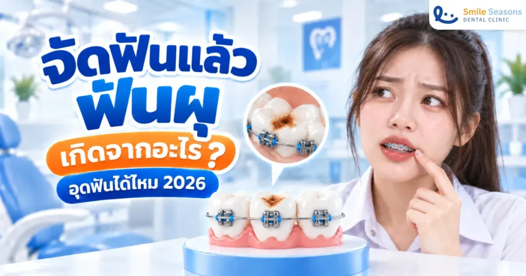จัดฟันแล้วฟันผุ เกิดจากอะไร อุดฟันได้ไหม 2026