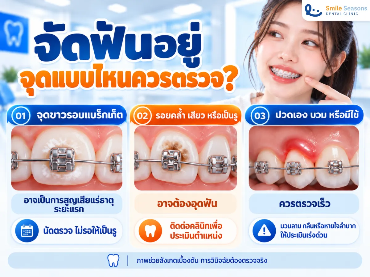 เปรียบเทียบจุดขาว รอยผุ และอาการที่ควรพบทันตแพทย์ระหว่างจัดฟัน