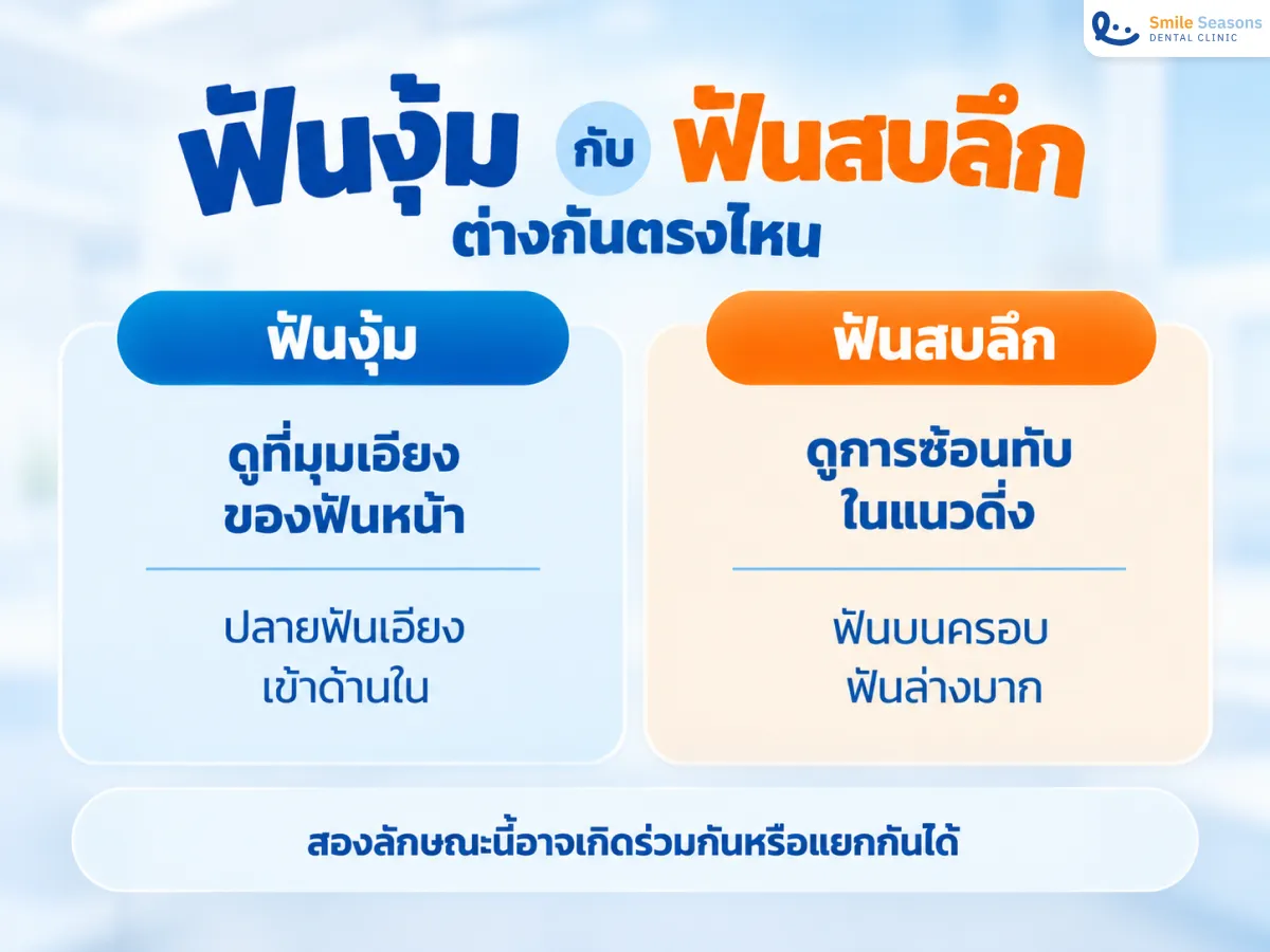 เปรียบเทียบฟันงุ้มกับฟันสบลึกจากมุมฟันหน้าและการซ้อนทับของฟัน